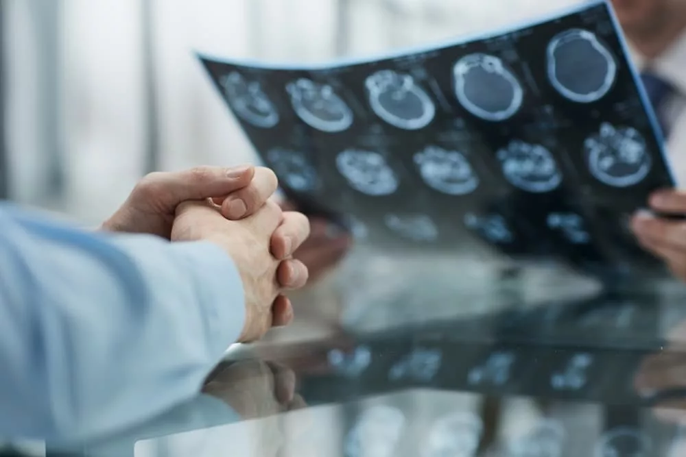 How Much Compensation Do You Get for a Brain Injury